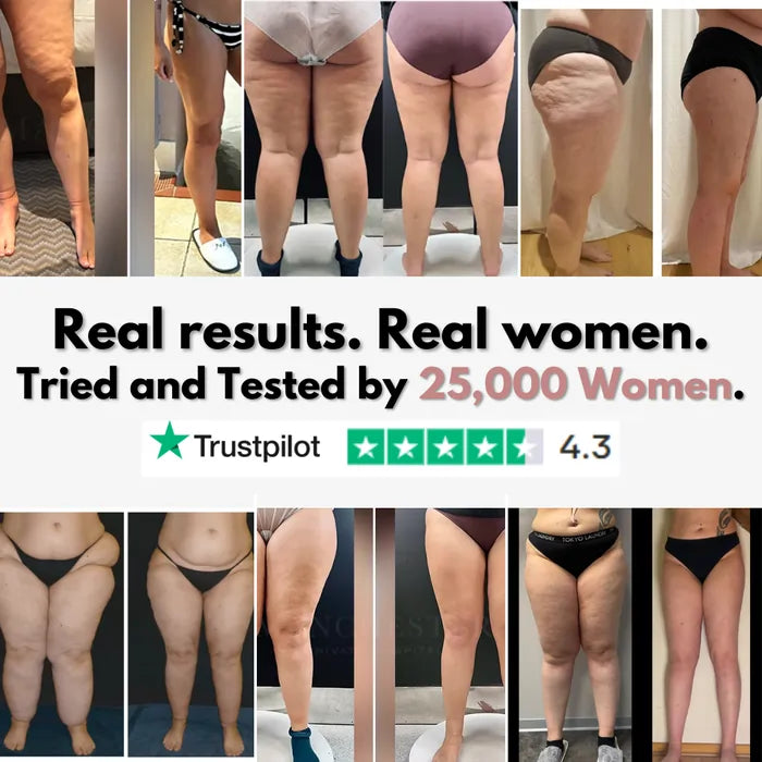 Urbanvelle 3D Legging – Say goodbye to lipoedema pain and swelling naturally