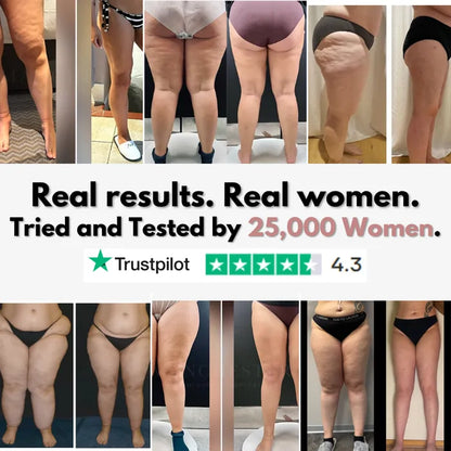 Urbanvelle 3D Legging – Say goodbye to lipoedema pain and swelling naturally