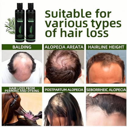 Urbanvelle Organic Rosemary Hair Growth Shampoo