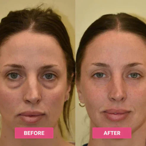 REVIVE TIRED EYES -HYDRATING & ANTI-WRINKLE EYE BALM