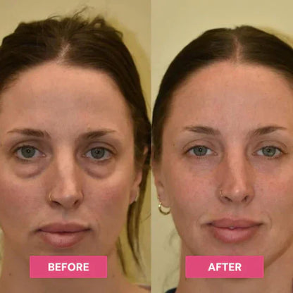 REVIVE TIRED EYES -HYDRATING & ANTI-WRINKLE EYE BALM