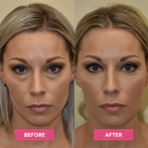 REVIVE TIRED EYES -HYDRATING & ANTI-WRINKLE EYE BALM