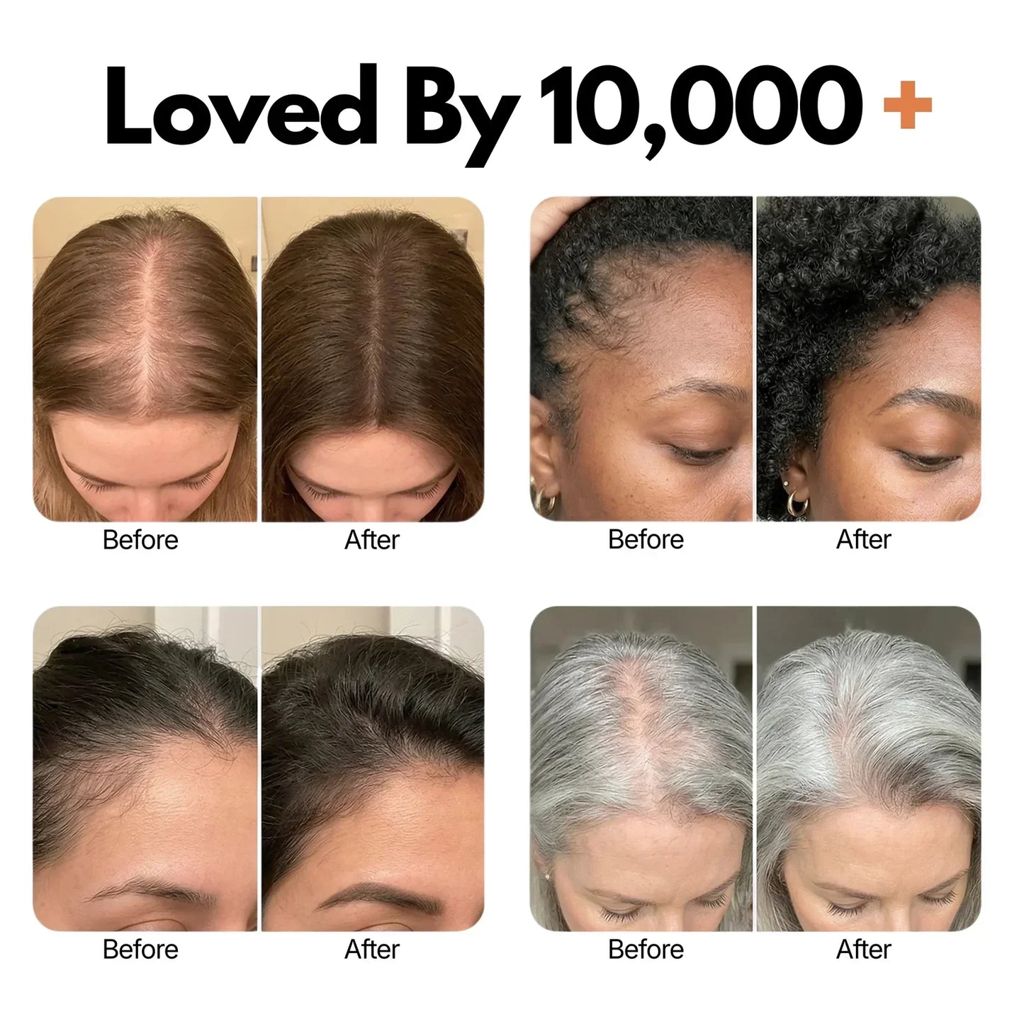 Urbanvelle Hair Growth Serum