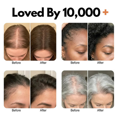 Urbanvelle Hair Growth Serum