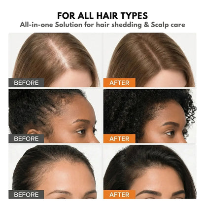 Urbanvelle Hair Growth Serum