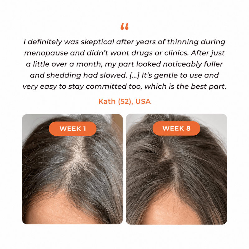 Urbanvelle Hair Growth Serum