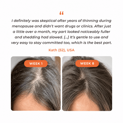 Urbanvelle Hair Growth Serum